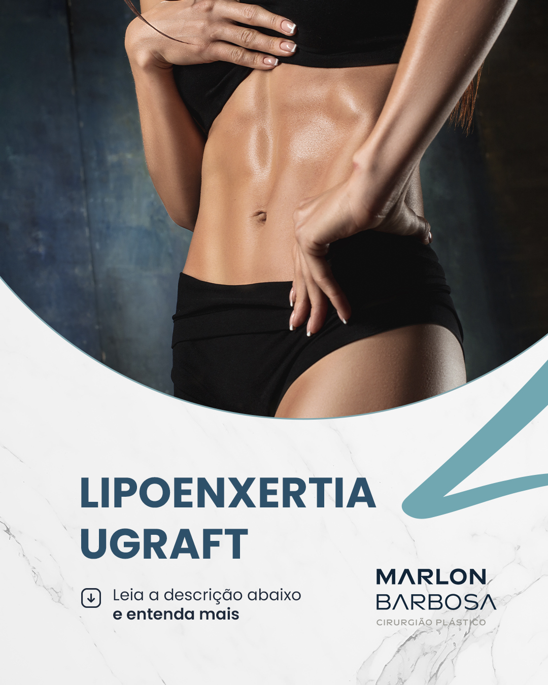 Normas Atualizadas para Lipoenxertia UGraft...